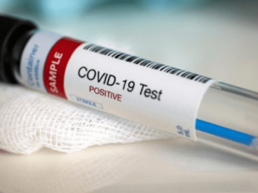 OBSH tregon sa për qind e popullsisë duhet të infektohet që të zhduket koronavirusi