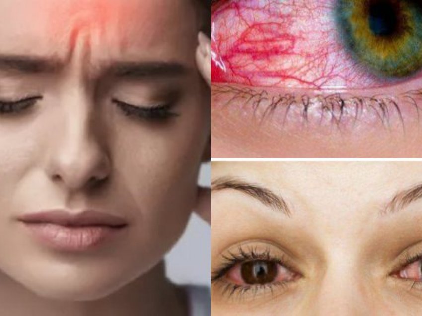 Lloji i ri i COVID-19: Këto janë tri simptomat që shfaqen në sytë tuaj