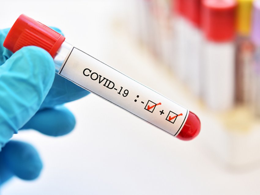 Shtatë të vdekur dhe 296 raste të reja me koronavirus
