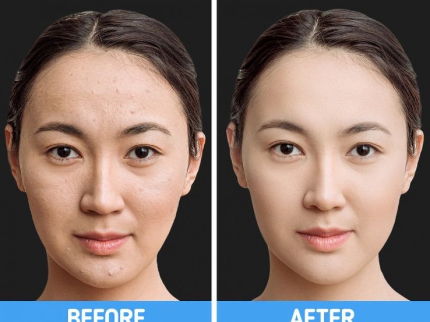 Teknika 4-2-4 nga Azia ju ndihmon të keni një lëkurë perfekte të fytyrës