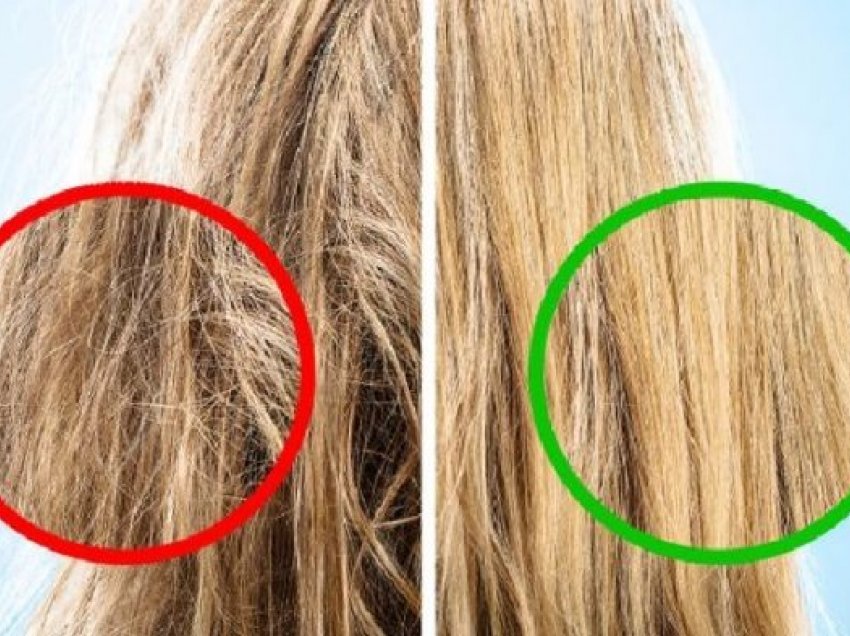 5 gabime që duhet t’i shmangni për të shpëtuar flokët