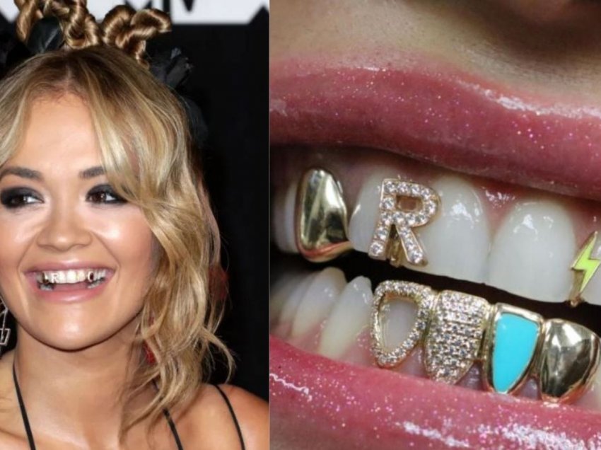 Dhëmbët e Rita Orës, me ari dhe gurë të çmuar
