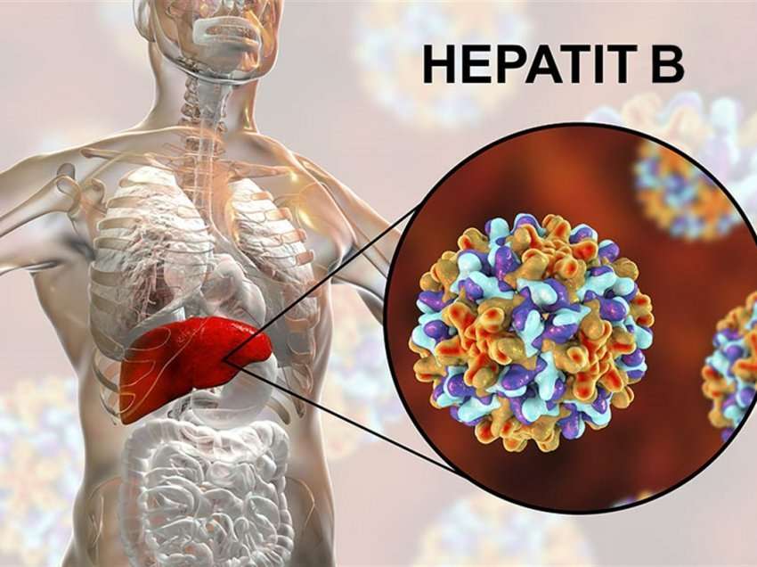 Çfarë është hepatiti B dhe cilët janë shkaktarët e tij?