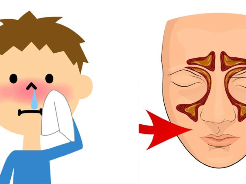 3 simptomat paralajmëruese të sinuseve të bllokuara që s'duhen ngatërruar me gripin dhe ftohjen