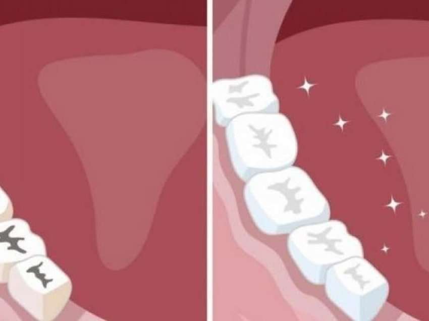Zhdukni dëmtimet e dhëmbëve, ja 8 këshillat e thjeshta…