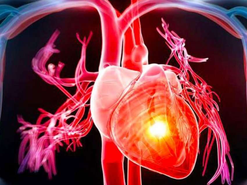 Sëmundjet koronare të zemrës, si parandalohen
