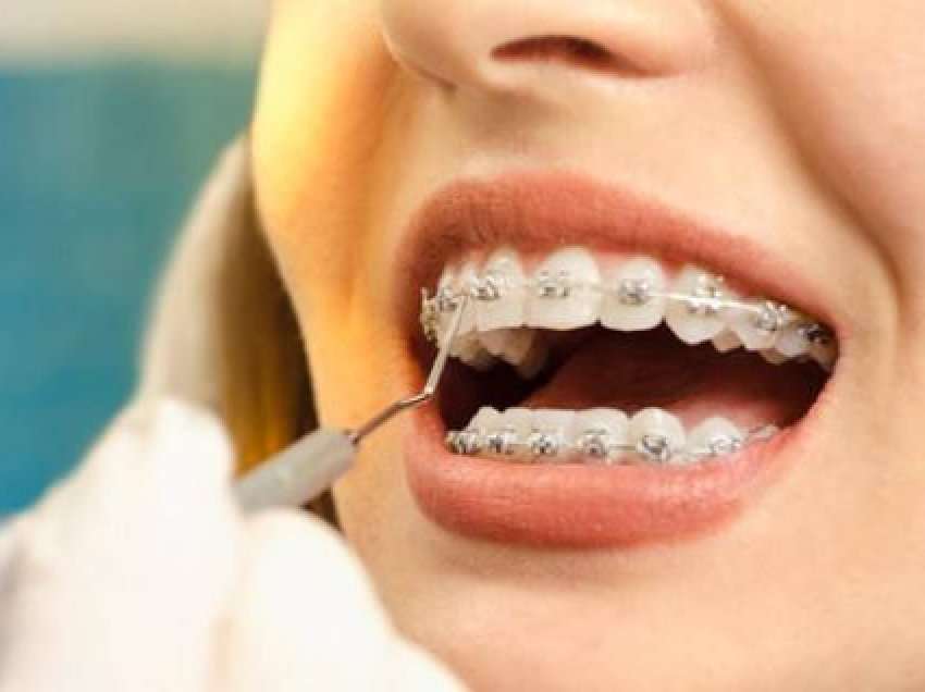 Ilaçe shtëpiake që ndihmojnë në shërimin e mishrave të dhëmbëve nga gjakderdhja