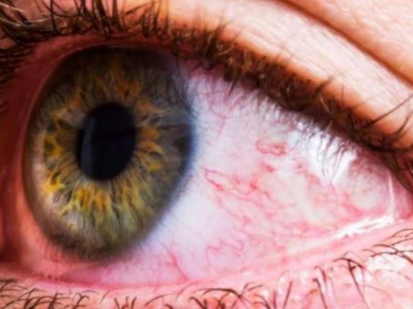Sytë mund të zbulojnë se si është gjendja juaj shëndetësore 