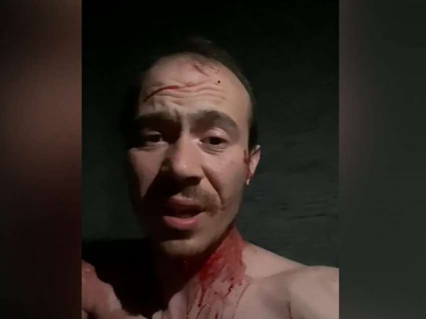 Pamje të rënda, gazetari i REL-it plagoset nga sulmi rus