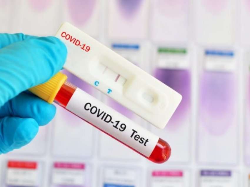 Regjistrohen dy viktima dhe 319 raste të reja me koronavirus në Maqedoni