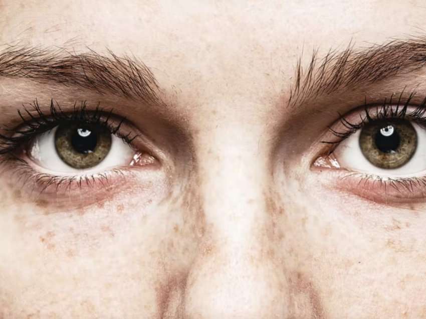 Çfarë tregojnë sytë për shëndetin tuaj