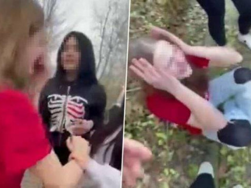 Ngjarja që shokoi Gjermaninë: 13-vjeçarja torturohet nga disa vajza, ia shkundin hirin e cigares dhe ia djegin flokët