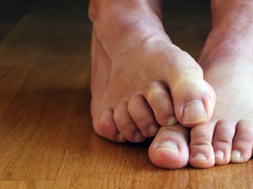 5 këshilla për këmbët e shëndetshme