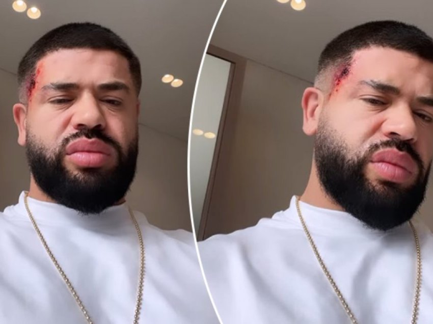 Noizy publikon video me gjakosje në fytyrë, shqetësohen fansat