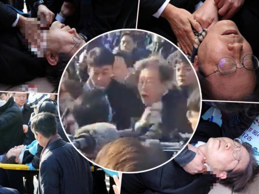 Pamjet tmerruese/ Lideri i opozitës në Korenë e Jugut goditet me thikë në qafë gjatë një turneu në qytet