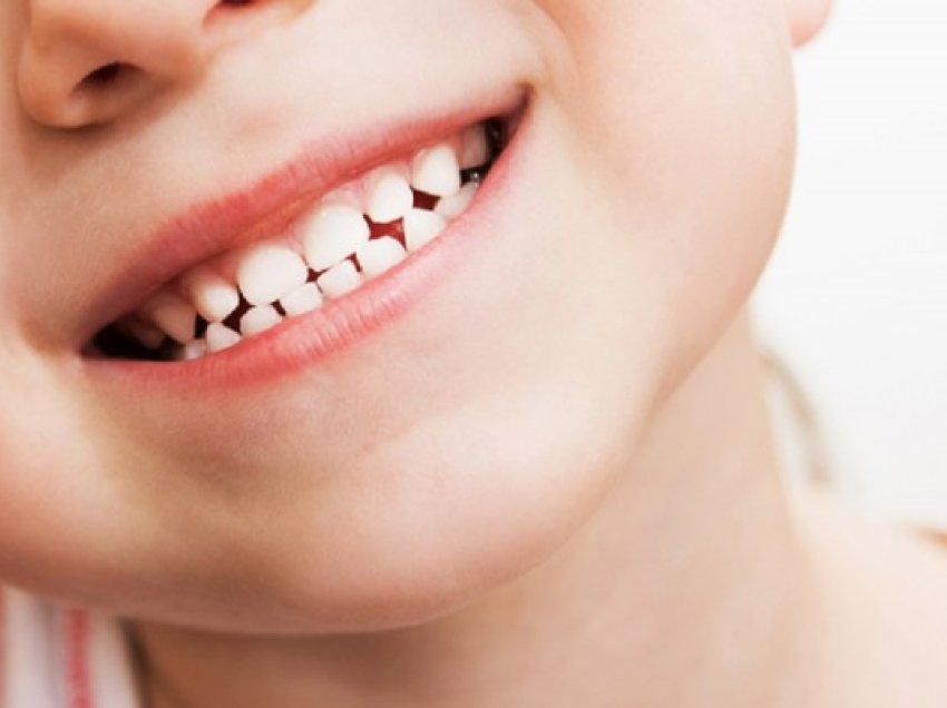 ​“Vizitat e fëmijëve para moshës 3 vjeçare te dentisti të bëhen të detyrueshme”