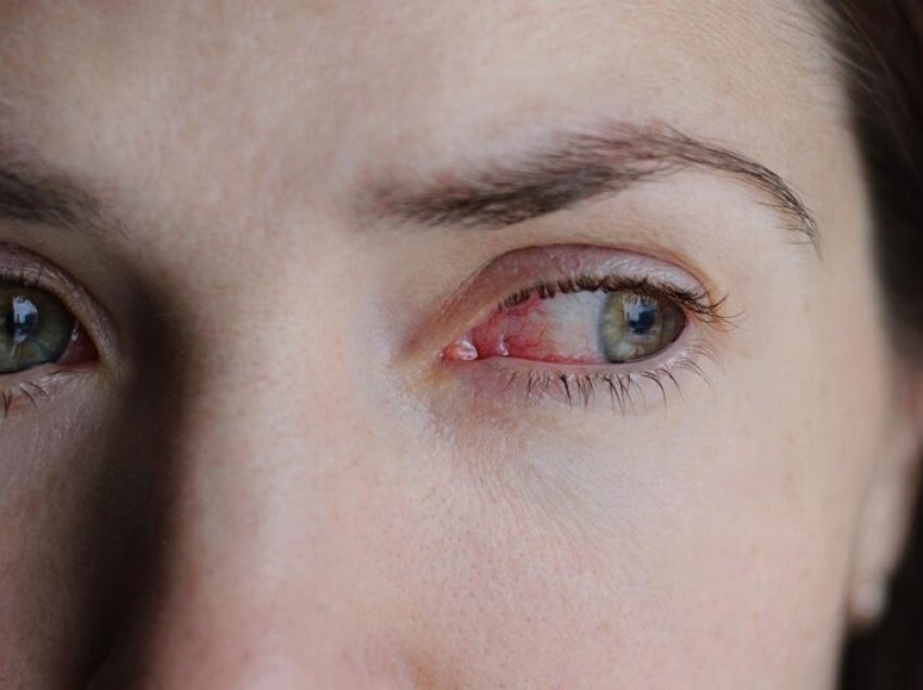 Një terapeutik i ri në formë të pikave të syve mund të jetë premtues në trajtimin e syve të dëmtuar nga diabeti