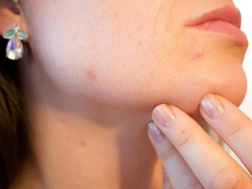  Dhjetë këshilla nga dermatologët që mund t’ju ndihmojnë të zvogëloni poret e mëdha në lëkurë