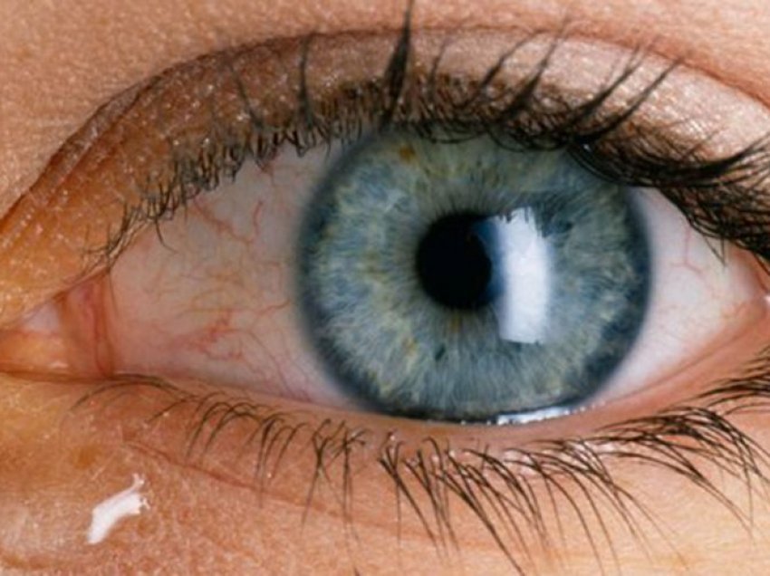 Tensioni i syrit – shkaqet, shenjat dhe kur duhet të shkoni patjetër te mjeku