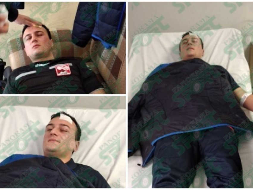 Plagoset rëndë gjyqtari në ndeshjen e kampionatit shqiptar, përfundon në spital