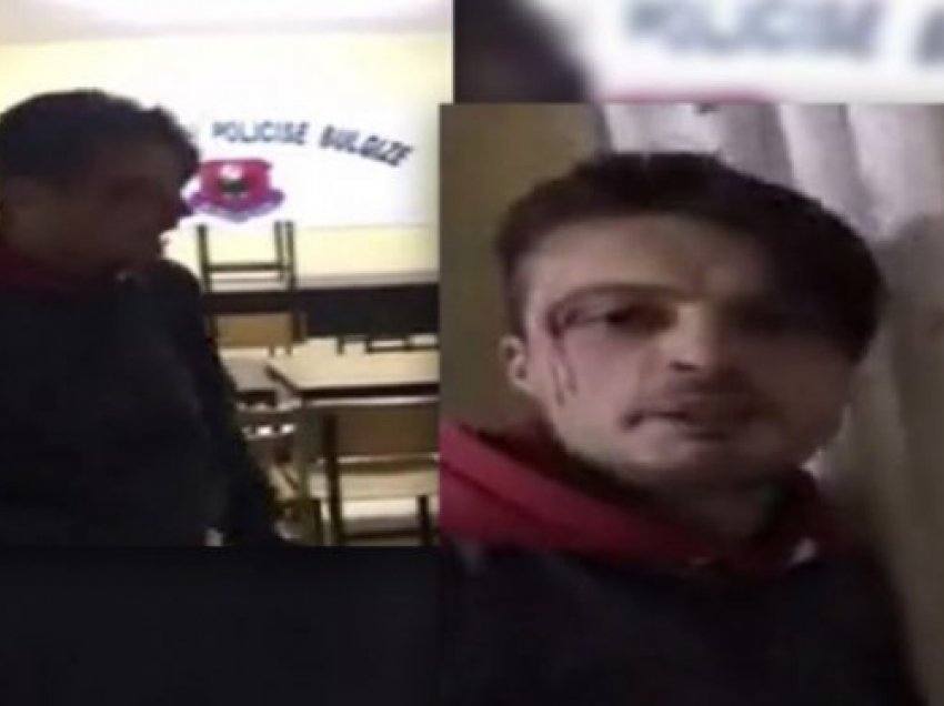 Dhunimi i të riut në Bulqizë/ Policia sqaron ngjarjen: Ishte ai që rrahu efektivët, i shkaktoi dëmtime fizike njërit
