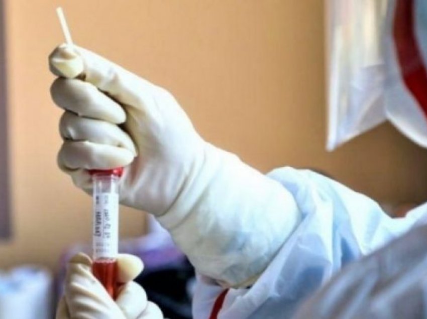 30 deri 39 vjeç, grupmosha më e prekur nga koronavirusi në Kosovë