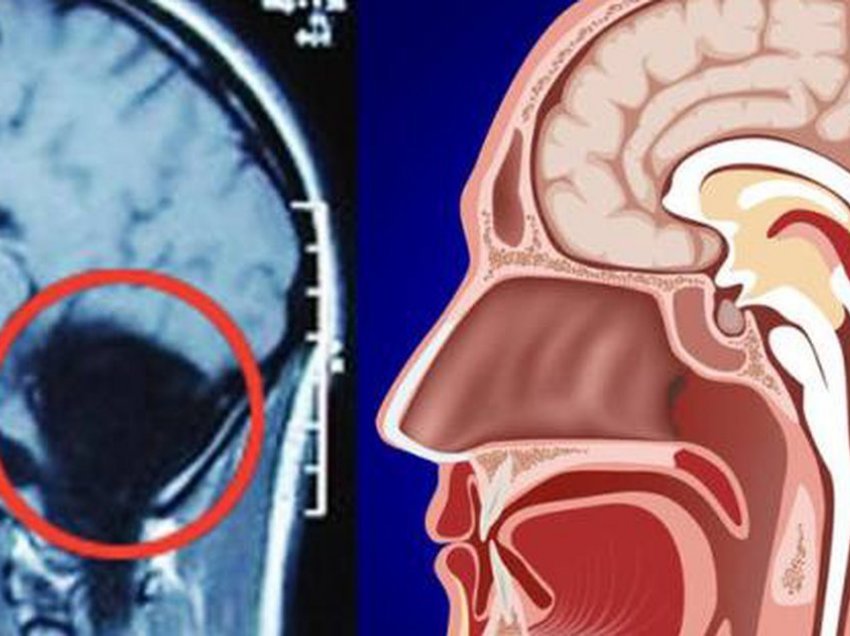 24-vjeçarja zbulon se i mungonte truri i vogël