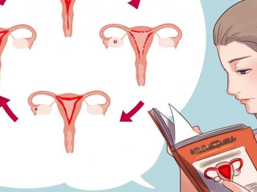 Ju mundojnë shumë menstruacionet? Kjo mund të jetë një shenjë e kancerit
