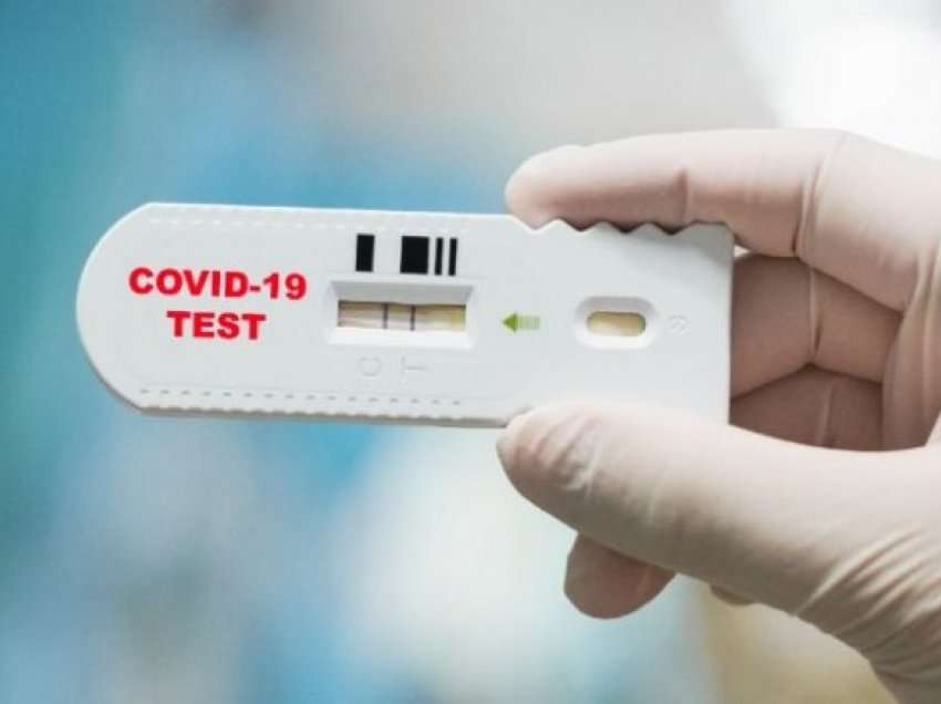 Fillon procedura për blerje të testeve të shpejta për COVID-19 në Maqedoni