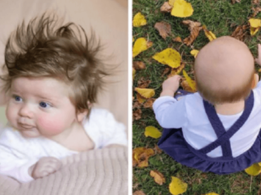 Pse disa fëmijë lindin me pak (ose aspak) e disa tjerë me shumë flokë?! 