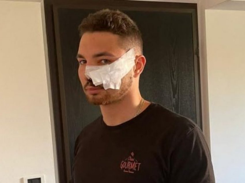 16-vjeçari shqiptar godet me thikë italianin, i shkaton plagë të rënda në fytyrë