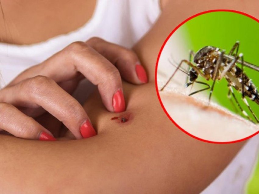 Pesë arsye pse jeni magnet për insektet