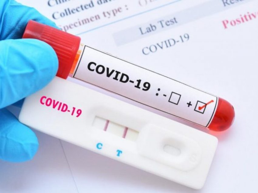 Vazhdon të rritet numri i rasteve me koronavirus në Itali 
