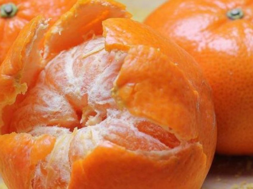 Probleme me frymëmarrjen dhe tretjen? “Magjia” e lëkurës së mandarinës do ju mahnisë