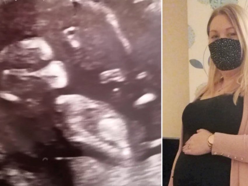 Nëna shpërndan ultrazërin e foshnjës që duket sikur po mban maskë