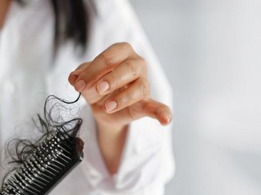 Studimi: Një në katër pacientë me Covid vuajnë nga rënia e flokëve, gratë janë më të rrezikuara