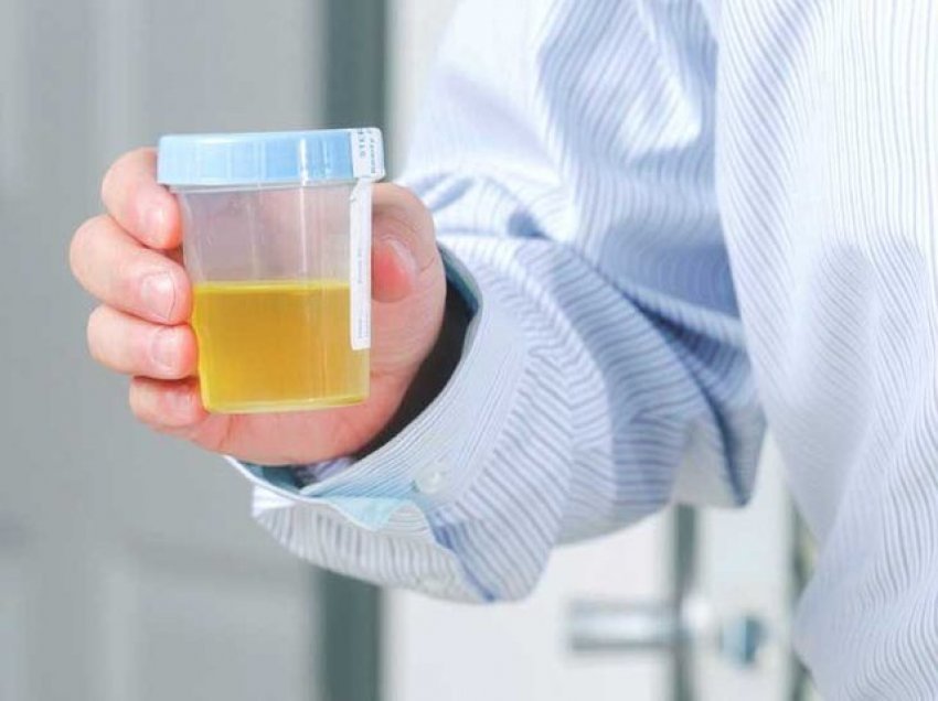 Çfarë tregon prezenca e epiteleve në analizat e urinës