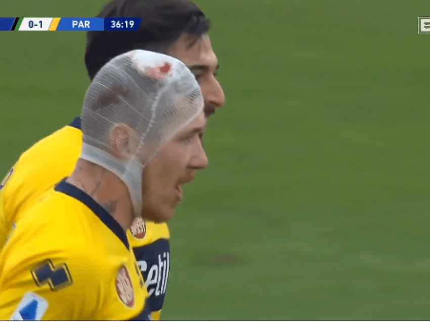 Luftëtari i Serie A, kokën me fashë