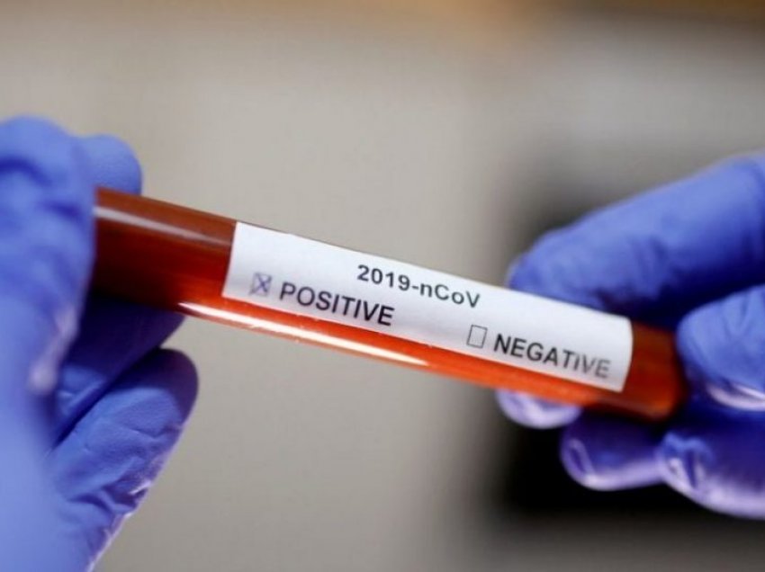 Varianti i ri i koronavirusit në Mbretërinë e Bashkuar ‘mund të jetë më vdekjeprurës’