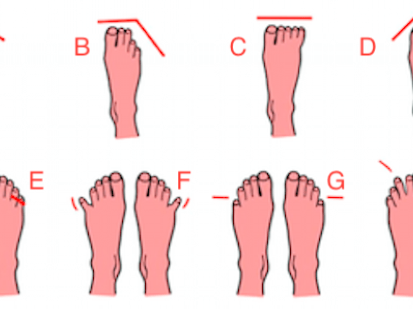 Çfarë mund të thotë forma e këmbës suaj për ju