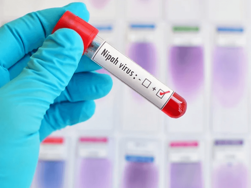 Është një prej dhjetë sëmundjeve infektive të identifikuara: Kompanitë farmaceutike nuk janë përgatitur për virusin Nipah