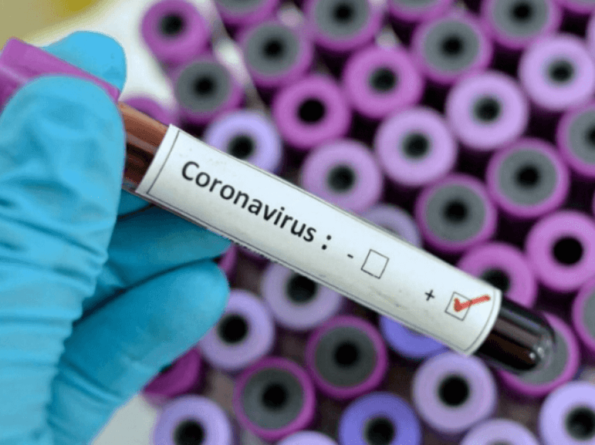 Australia ka shënuar ditën e dhjetë pa asnjë rast të ri me koronavirus