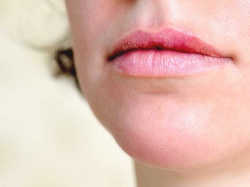 ​Forma e buzëve zbulon personalitetin tuaj
