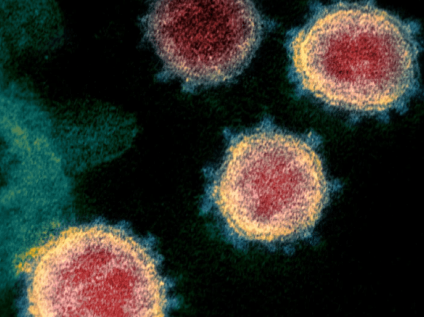 398 raste të reja me coronavirus