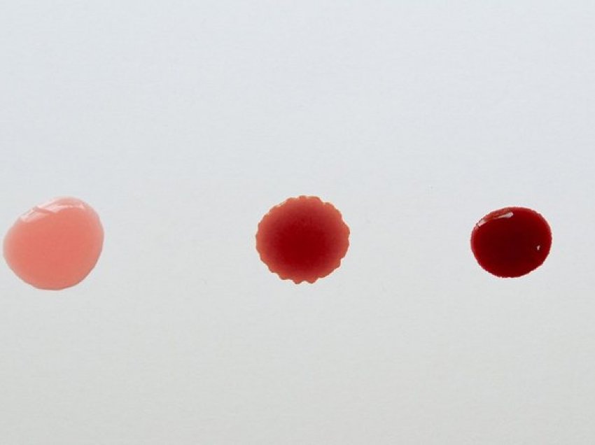 Nga infeksionet te kanceri: Gjakderdhja pas seksit – simptomat dhe shkaqet