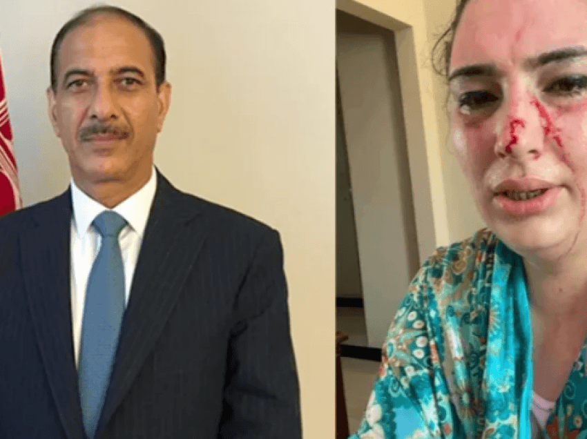 U rrëmbye vajza e diplomatit afgan në Pakistan, pësoi lëndime të rënda