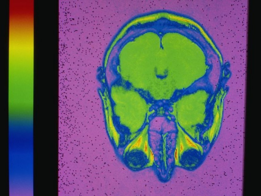 Shkencëtarët filmojnë lëvizjen e një mendimi në tru. Ja çfarë ndodh para se një person të përgjigjet