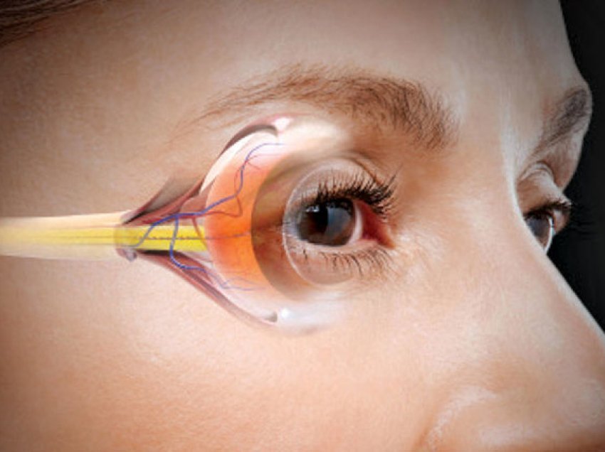 Shëndeti i syve/ Njihuni me 6 simptoma që nuk duhet t’i injoroni