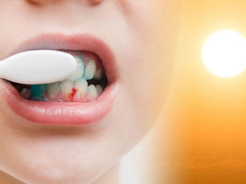 Mungesën e vitaminës C mund të tregojë gjakrrjedhja e mishit të dhëmbëve