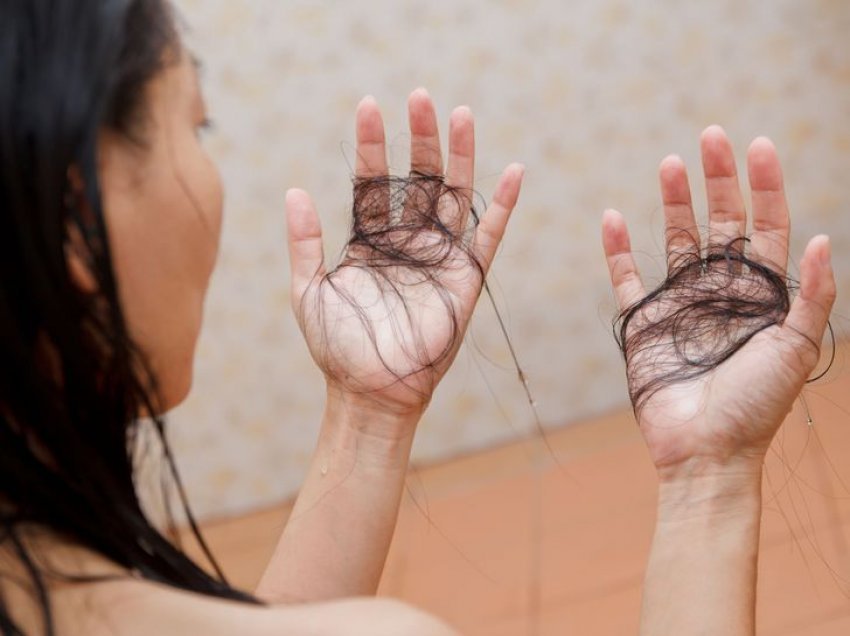 Shtatë mënyra për të kuptuar nëse po humbisni shumë flokë brenda një periudhë të shkurtër